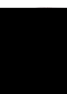 ALCHEMILLA VULGARIS D 2 Dilution